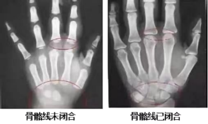 测骨龄、看牙齿、防近视……这里全免费！